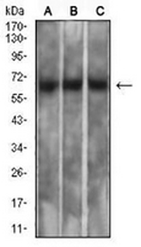 Mesothelin Mouse Monoclonal Antibody