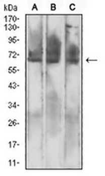 Mesothelin Mouse Monoclonal Antibody