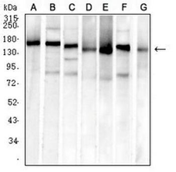 MSH6 Mouse Monoclonal Antibody