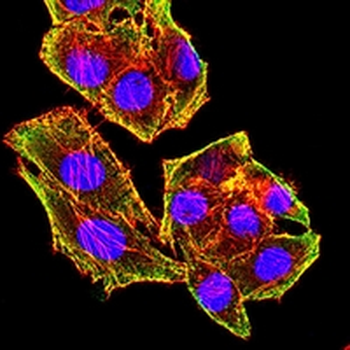 MSH6 Mouse Monoclonal Antibody