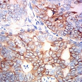 MSH6 Mouse Monoclonal Antibody
