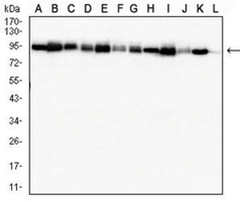 MSH2 Mouse Monoclonal Antibody