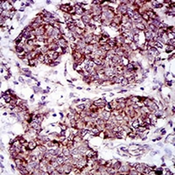 MRPS32 Mouse Monoclonal Antibody