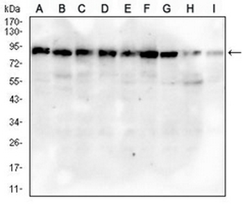 MRE11 Mouse Monoclonal Antibody