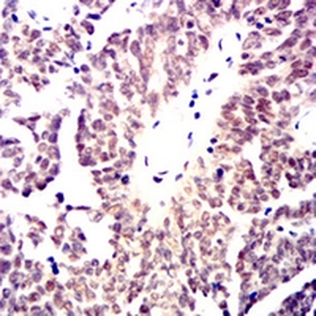 MRE11 Mouse Monoclonal Antibody