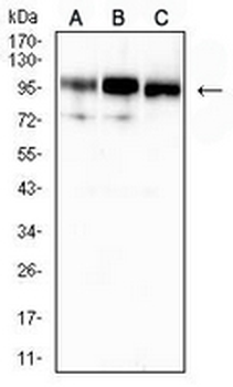 CD10 Mouse Monoclonal Antibody
