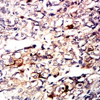 CD10 Mouse Monoclonal Antibody
