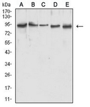 MLH1 Mouse Monoclonal Antibody