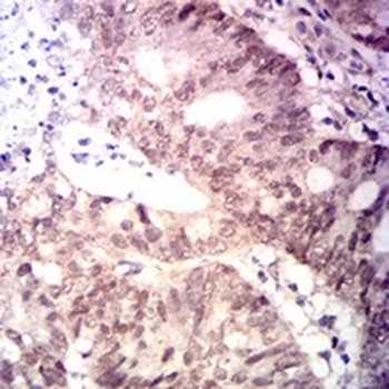 MLH1 Mouse Monoclonal Antibody