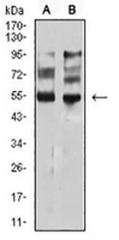 MITF Mouse Monoclonal Antibody