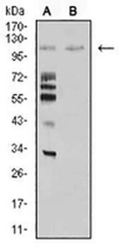 MIB1 Mouse Monoclonal Antibody