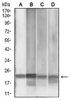 MGMT Mouse Monoclonal Antibody