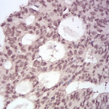 MGMT Mouse Monoclonal Antibody