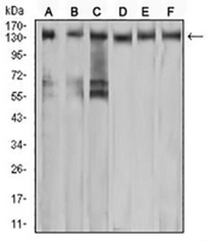 c-Met Mouse Monoclonal Antibody