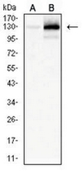 MERTK Mouse Monoclonal Antibody