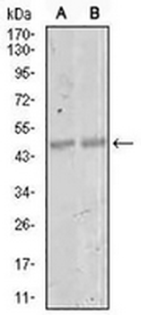 MEF2C Mouse Monoclonal Antibody