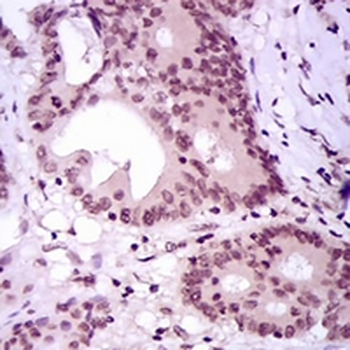 MEF2C Mouse Monoclonal Antibody