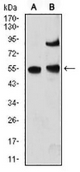 MeCP2 Mouse Monoclonal Antibody