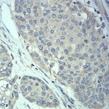 MeCP2 Mouse Monoclonal Antibody