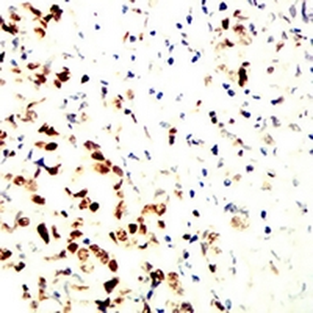 MCM3 Mouse Monoclonal Antibody