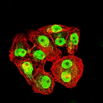 MCM3 Mouse Monoclonal Antibody