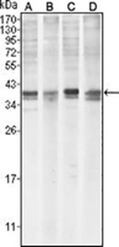 MCL1 Mouse Monoclonal Antibody