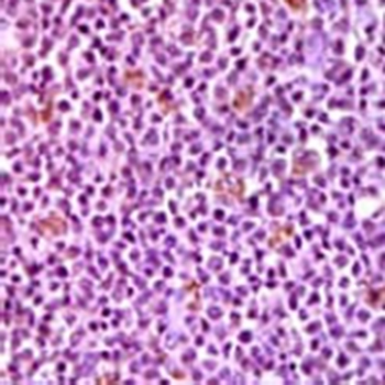 MCL1 Mouse Monoclonal Antibody
