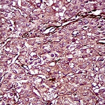 CD146 Mouse Monoclonal Antibody