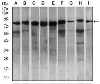 MARK3 Mouse Monoclonal Antibody