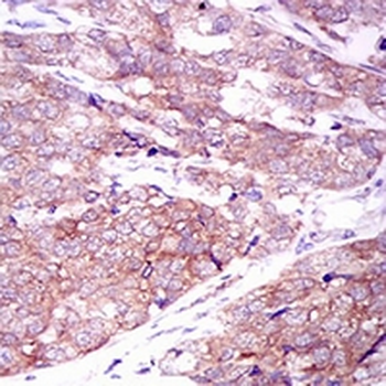 MARK3 Mouse Monoclonal Antibody