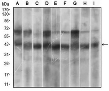p38 Mouse Monoclonal Antibody