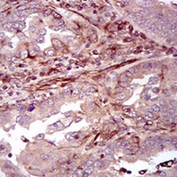 p38 Mouse Monoclonal Antibody