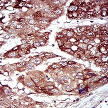 MKK5 Mouse Monoclonal Antibody