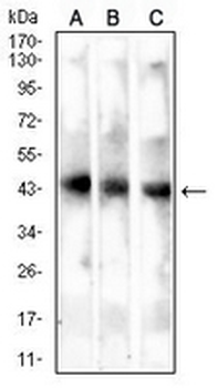 MAGEA4 Mouse Monoclonal Antibody