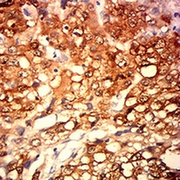 MAGEA4 Mouse Monoclonal Antibody