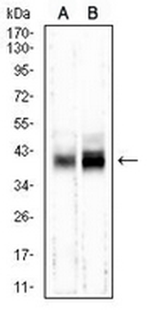 M6PR Mouse Monoclonal Antibody