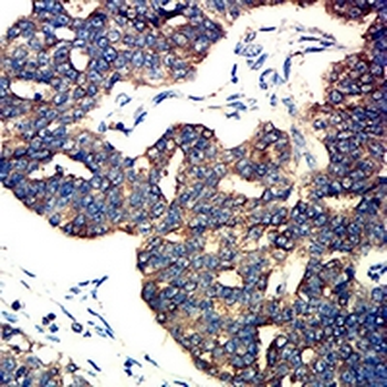 M6PR Mouse Monoclonal Antibody