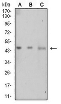 LTBR Mouse Monoclonal Antibody