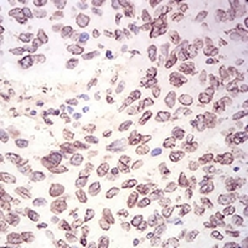 Lamin B2 Mouse Monoclonal Antibody