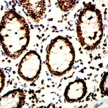 Lamin B1 Mouse Monoclonal Antibody