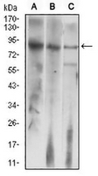 LH Receptor Mouse Monoclonal Antibody