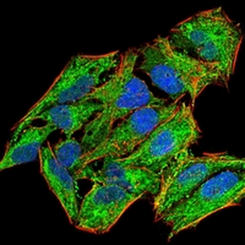 LH Receptor Mouse Monoclonal Antibody