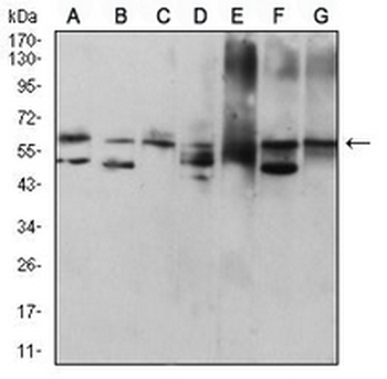 Cytokeratin 9 Mouse Monoclonal Antibody