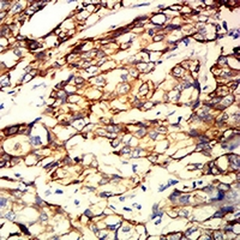 Cytokeratin 9 Mouse Monoclonal Antibody