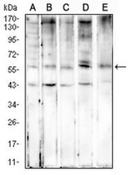 Cytokeratin 6 Mouse Monoclonal Antibody