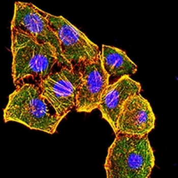 Cytokeratin 6 Mouse Monoclonal Antibody