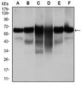 Cytokeratin 5 Mouse Monoclonal Antibody