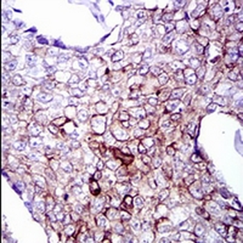 Cytokeratin 5 Mouse Monoclonal Antibody