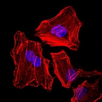 Cytokeratin 5 Mouse Monoclonal Antibody