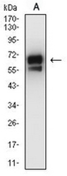 Cytokeratin 2 Mouse Monoclonal Antibody